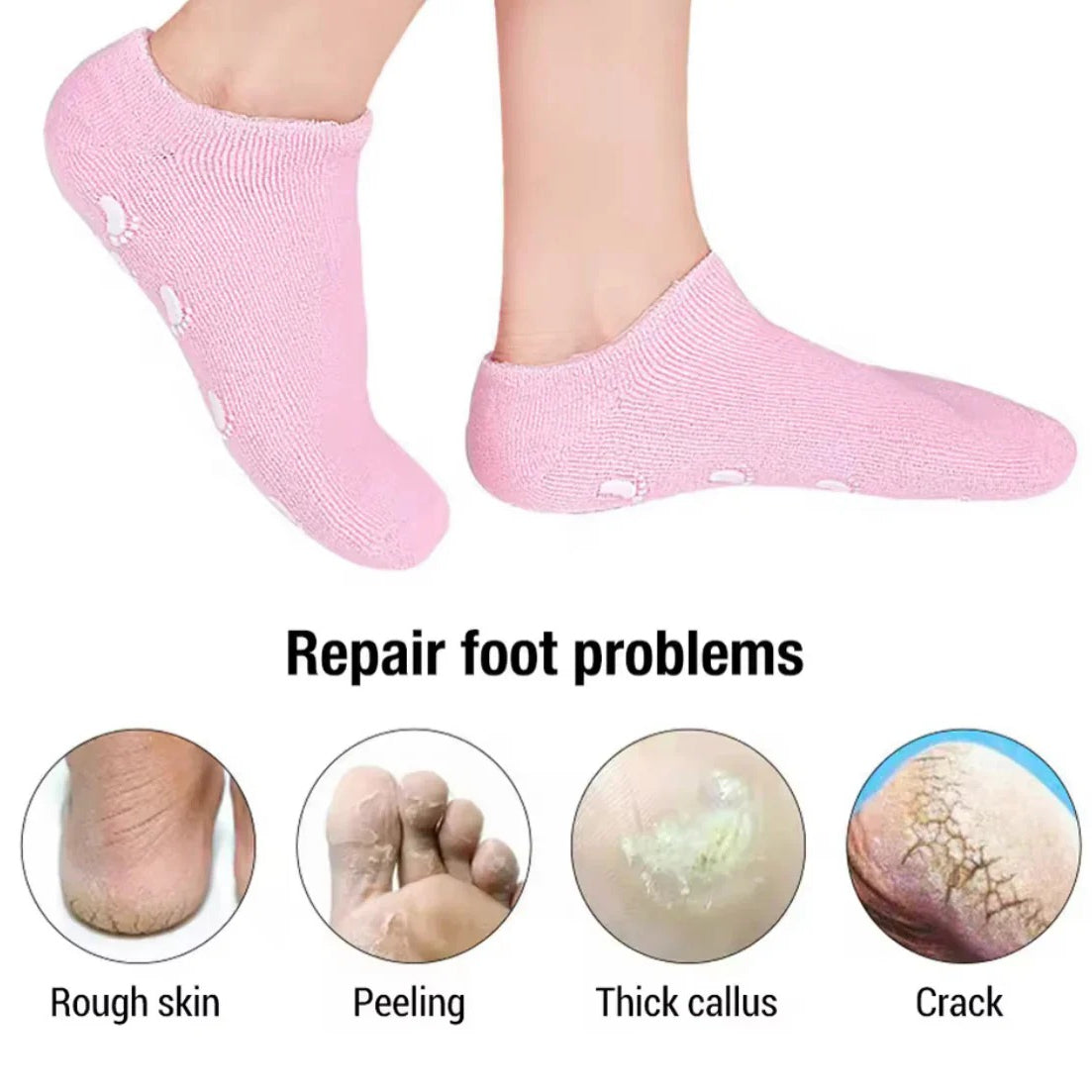 Spa Gel Heel Socks Dry Cracked Heel Relief Nexusmart view 3 - Nexusmart Pakistan